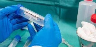 Ricerca, nella saliva 2 spie della demenza a corpi di Lewy, studio Sapienza