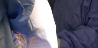 Roma, muore a 62 anni dopo liposuzione in una clinica privata