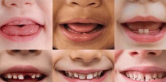 Salute Orale, l’Abc della prevenzione si impara in famiglia