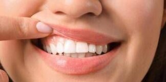 Salute ‘in 70% persone con autismo problemi a denti e gengive’, parodontologi in campo