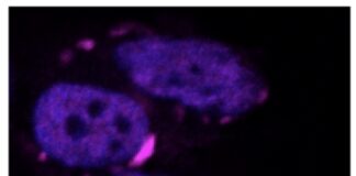 Ia, algoritmo Iit va a caccia di proteine dannose per il cervello