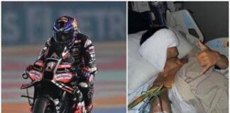 Martin, dopo l’incidente in Qatar il ricovero: “Poteva andare molto peggio”