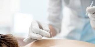 Tra aghi e neuroni, ‘oltre 2 mln di italiani scelgono l’agopuntura’