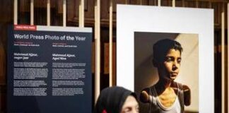 World Press Photo, nella foto dell’anno un bambino mutilato a Gaza