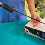 Nuovo strumento laparoscopico robotizzato all’ospedale di Arzignano: avanzamenti nella chirurgia urologica chirurgia robotica prostata