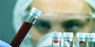 Salute, comuni abitudini che falsano esami e test, medici svelano quali sono