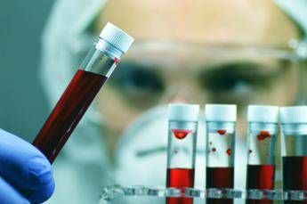 Salute, comuni abitudini che falsano esami e test, medici svelano quali sono