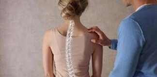 Scoliosi dell’adulto, tutte le novità dai trattamenti alla chirurgia