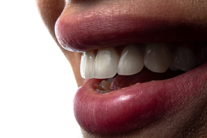 Denti bianchi Denti bianchi