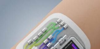 Diagnosi del Parkinson: sviluppato un cerotto indossabile per il monitoraggio dei biomarcatori