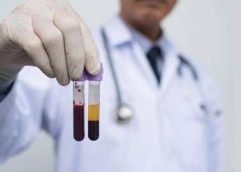 Farmaceutica, Gardini (GenomeUp): “Ai per programmare terapie con plasmaderivati”