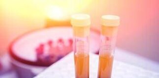 Farmaci, Sava (Sif Magazine): “In plasmaderivati attenzione particolare a sicurezza”