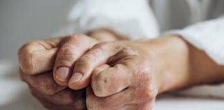 Lo studio, inibitore Il-23 riduce segni e sintomi artrite psoriasica attiva