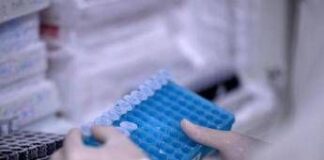 Melanoma, glicemia alta dimezza la sopravvivenza in pazienti senza diabete