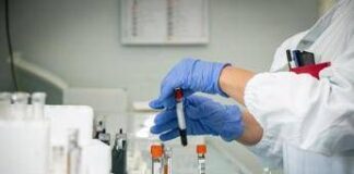 Mielofibrosi, ematologo: “Con uso precoce momelotinib maggiore sopravvivenza”