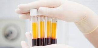 Plasmaderivati, Lecci (Sda Bocconi): “Serve un’innovazione rapida meno costosa”