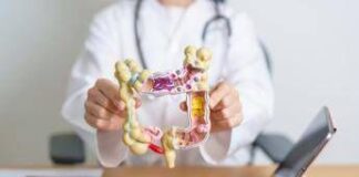 Tumori, Garufi (San Camillo): “Il tumore del colon retto si può prevenire ma l’adesione agli screening è troppo bassa”