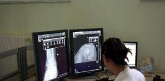Un italiano su 4 è over 65, Sirm: “Prevenzione personalizzata con radiologia geriatrica”