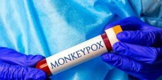 Vaiolo delle scimmie, caso a Terni: fonte contagio ignota, monitorati 2 gatti di casa