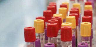 Seconda vittima per intossicazione da botulino in Sardegna, è una 62enne del Cagliaritano