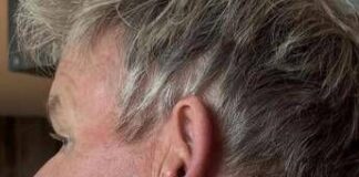 Gordon Ramsay: “Operato per tumore della pelle”