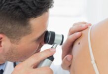 Veneto, polemica su tagli mappatura dei nei: Manildo e Fantò all’attacco, la Regione: “sono riduzione Lea ma per pazienti non cambia supporto” Mappatura nei