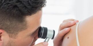 Veneto, polemica su tagli mappatura dei nei: Manildo e Fantò all’attacco, la Regione: “sono riduzione Lea ma per pazienti non cambia supporto” Mappatura nei