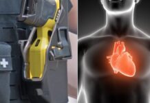Taser, scontro tra Formaggio (FdI) e PRC Vicenza. Consigliere regionale: “Serve a proteggere agenti”. Rifondazione: “Violenza istituzionale” Taser ed effetti possibili sul cuore