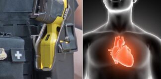 Taser, scontro tra Formaggio (FdI) e PRC Vicenza. Consigliere regionale: “Serve a proteggere agenti”. Rifondazione: “Violenza istituzionale” Taser ed effetti possibili sul cuore