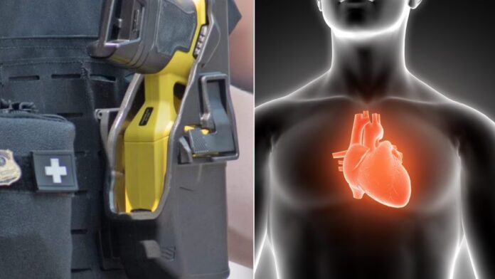 Taser ed effetti possibili sul cuore