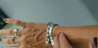 Torna la scabbia, in Italia +750% casi in 3 anni. L’overtourism tra le cause