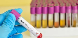 West Nile: muore 77enne, quinta vittima nel Lazio e 11esima in Italia west nile