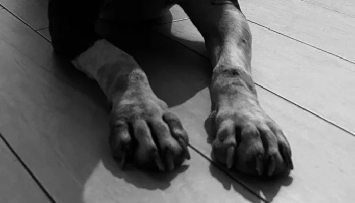 zampe_cane_adn messina cane