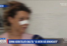 Parla in tv Fernanda, la barista di Marostica accoltellata dall’ex marito: “Era ossessionato. Sono viva grazie al coraggio di Roberta” donna accoltellata a Marostica parla in tv