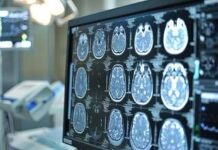Giornata mondiale dell’Alzheimer, neurologi: “Ora percorsi cura più efficaci e sostenibili”
