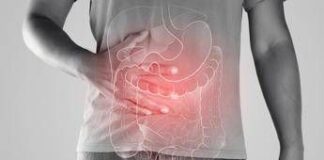 Malattie infiammatorie croniche, l’indagine: ‘4 pazienti su 5 non ricevono consulenze nutrizionali’