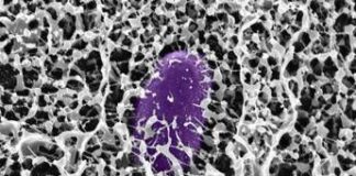 Scoperta del MIT: il muco contiene molecole che bloccano l’infezione da Salmonella