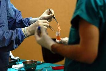 Trapianti, a Modena il primo in Europa di fegato da donatore vivente con robot