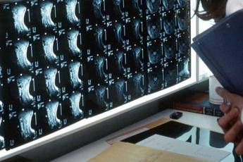 Oltre 500 malattie rare delle ossa, esperti: “Investire in prevenzione e diagnosi”