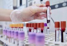 Sclerosi multipla recidivante, Ema raccomanda approvazione ocrelizumab dai 10 anni