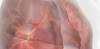 Innovazioni terapeutiche nella BPCO con enfisema