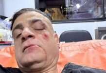 Cicalone, lo youtuber aggredito in metro a Roma: “Infami veri”