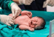 Sangue cordonale, meno del 3% delle coppie in Italia sceglie di donarlo