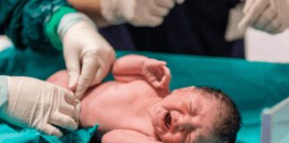 Sangue cordonale, meno del 3% delle coppie in Italia sceglie di donarlo