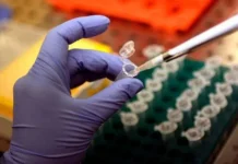 Focolaio di Legionella a Milano: 1 morto e 11 casi in zona San Siro: in corso le indagini di Ats legionella milano