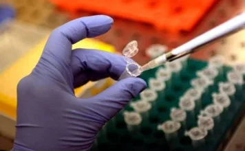 Focolaio di Legionella a Milano: 1 morto e 11 casi in zona San Siro: in corso le indagini di Ats legionella milano