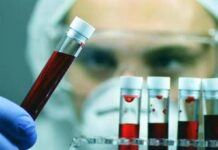 Leucemia linfatica cronica, con zanubrutinib sopravvivenza al 74% a 6 anni