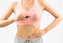 Tumore al seno, “numero allarmante di casi di cancro invasivo in donne più giovani”