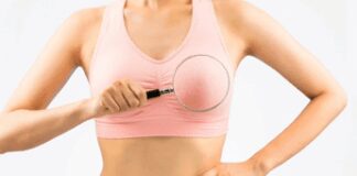 Tumore al seno, “numero allarmante di casi di cancro invasivo in donne più giovani”