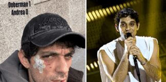 Bresh ferito al volto da un Dobermann, come sta il cantante